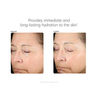 PCA Skin Hyaluronic Acid Boosting Serum | Advanced Hydrating Face Serum 30ml