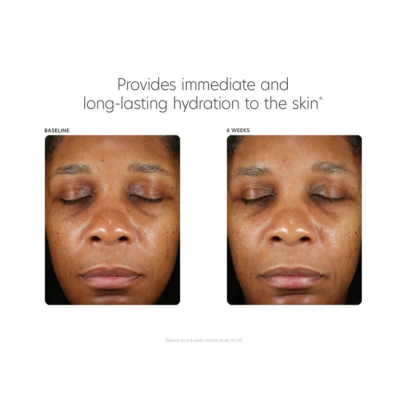 PCA Skin Hyaluronic Acid Boosting Serum | Advanced Hydrating Face Serum 30ml