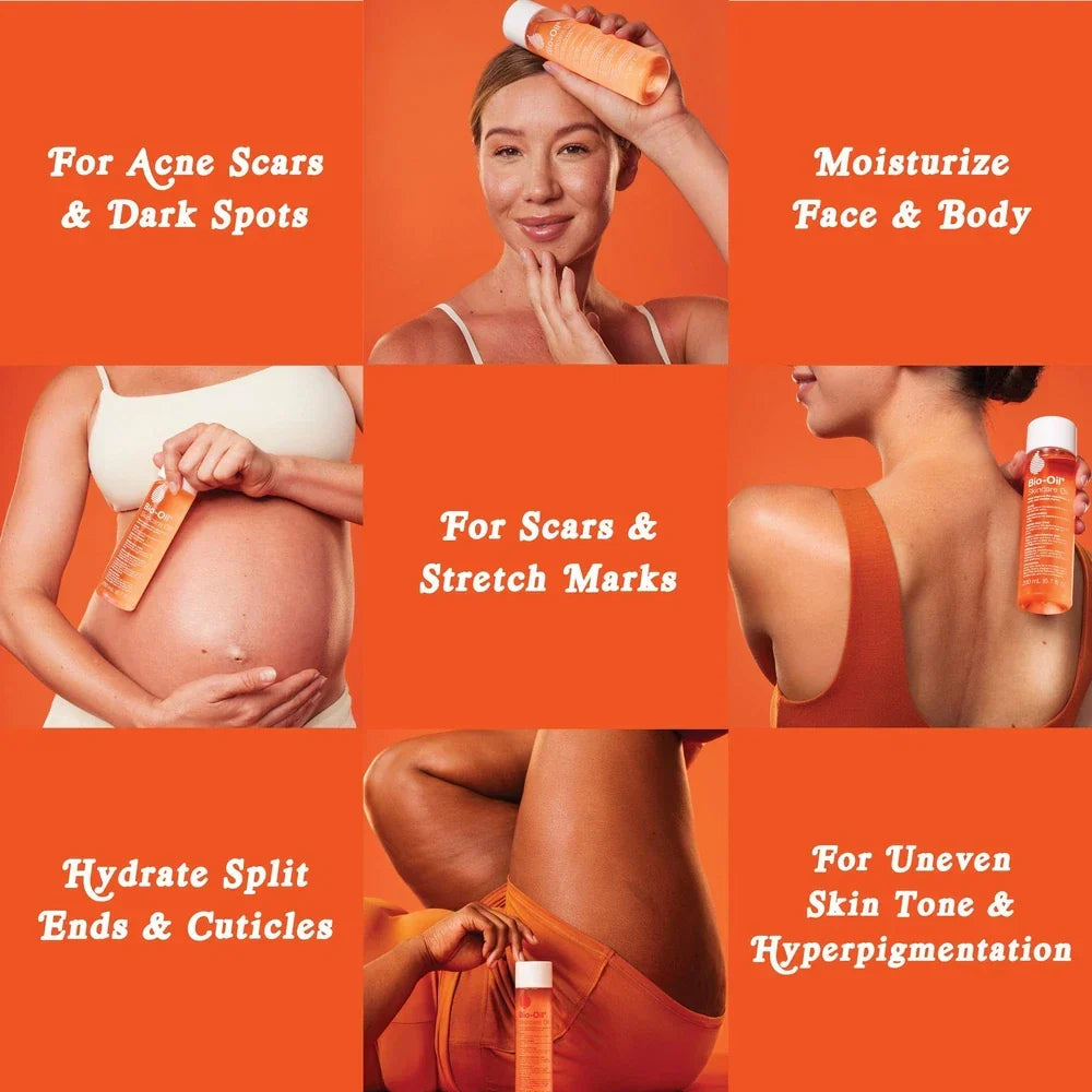 Bio-Oil Skincare Body Oil Serum – For Scars, Stretch Marks & Skin Hydration | Face & Body